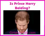 Is-Prince-Harry-Bald?