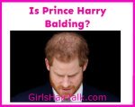 Is-Prince-Harry-Bald?
