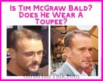 Is Tim McGraw Bald and does he wear a Toupee