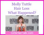 Molly-Tuttle-Bald-Hair-Loss-Female-Celebrity.jpg