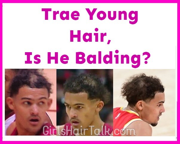 Trae-Young-Hair-Is-He-Balding.jpg