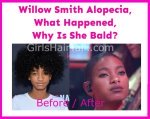 Does-Willow-Smith-HAve-Alopecia-Cancer-Why-IS-She-Bald