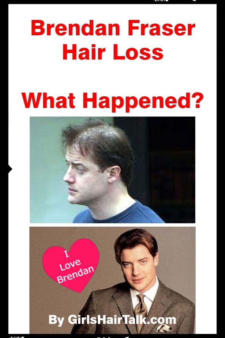 Brendan-Fraser-Hair-Loss-Balding.jpg