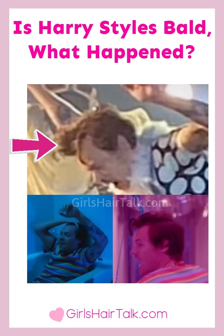 Is-Harry-Styles-Bald-What-Happened.jpg