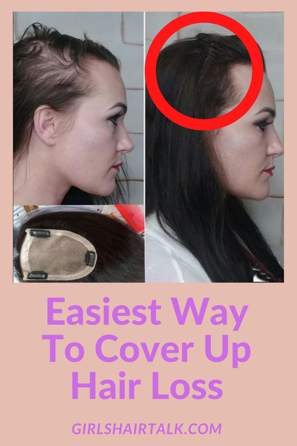 cover-up-hair-loss.png