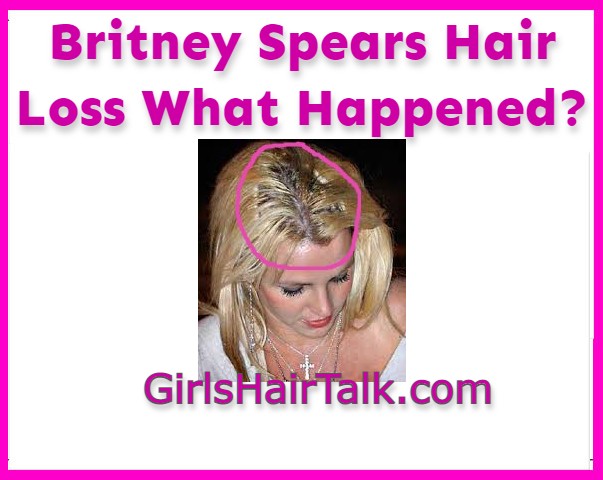 Britney Spears Celebrity Female Hair Loss