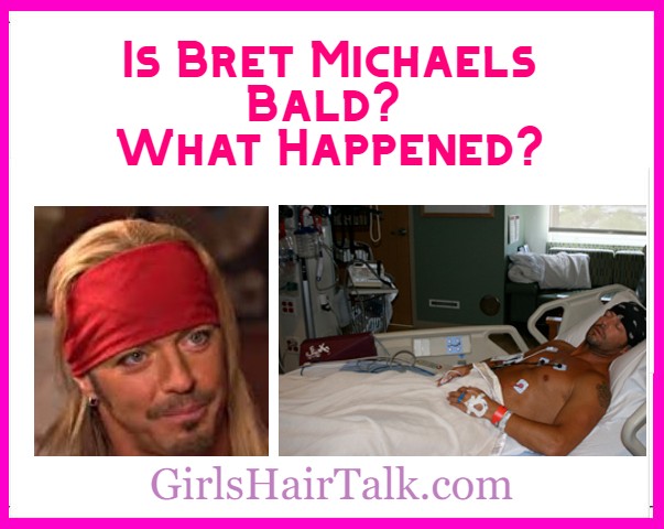Is Bret Michaels Bald 
