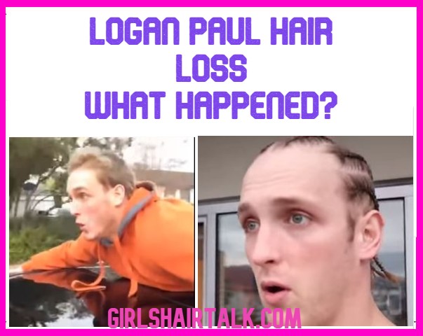 Logan Paul Hairline