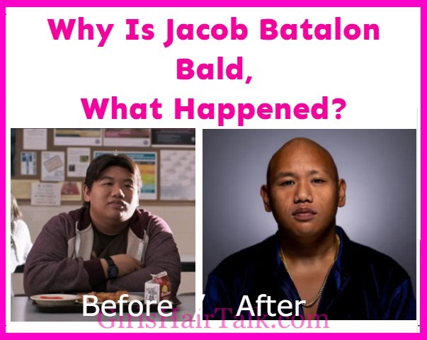 Why Is Jacob Batalon Bald?