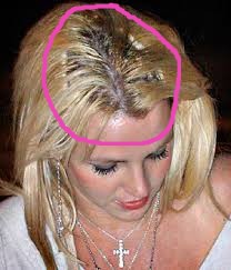 Spears with hair extension thinning hair loss.