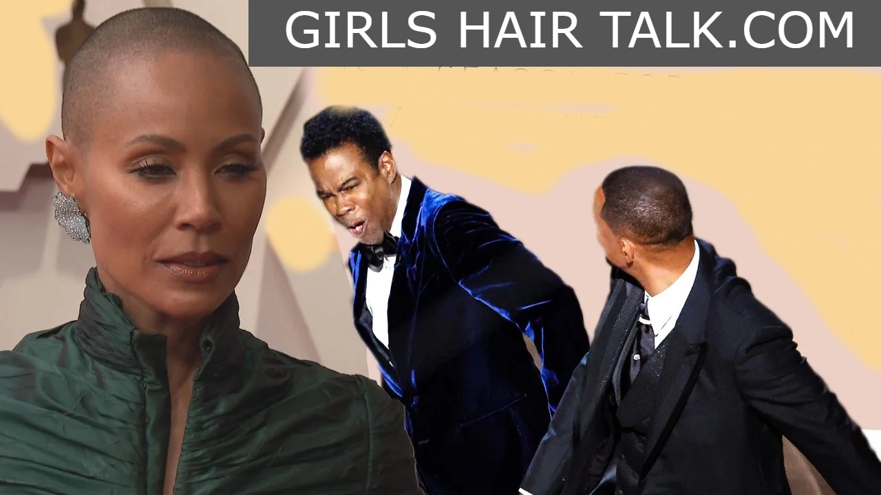 Hair_Loss_News_Celebrity Hair_Loss_News_Celebrity