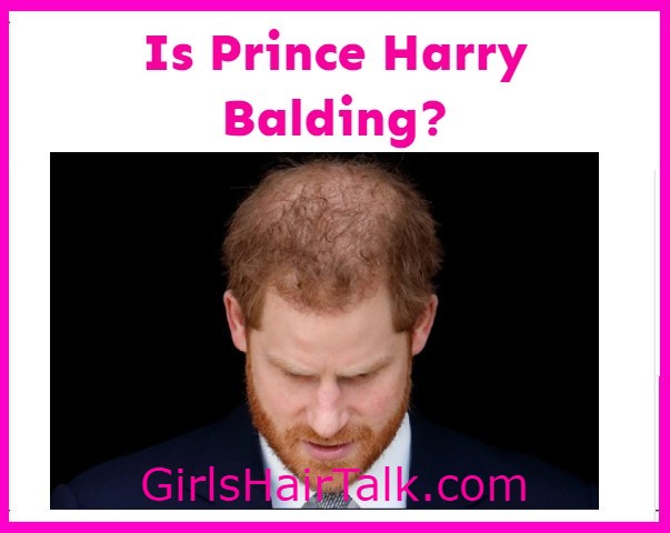 Is-Prince-Harry-Bald?