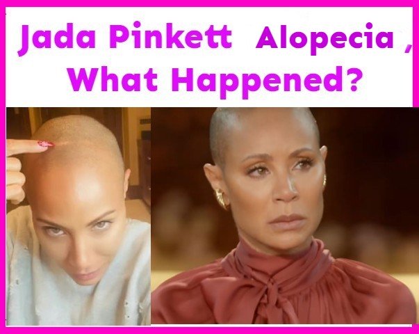 Jada Pinkett Hair Loss: Celebrity Female Hair Loss