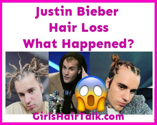 Justin-Bieber-Hair-Loss.jpg