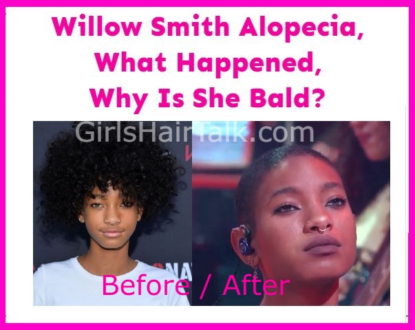 Does-Willow-Smith-Have-Alopecia-Cancer-Why-Is-She-Bald