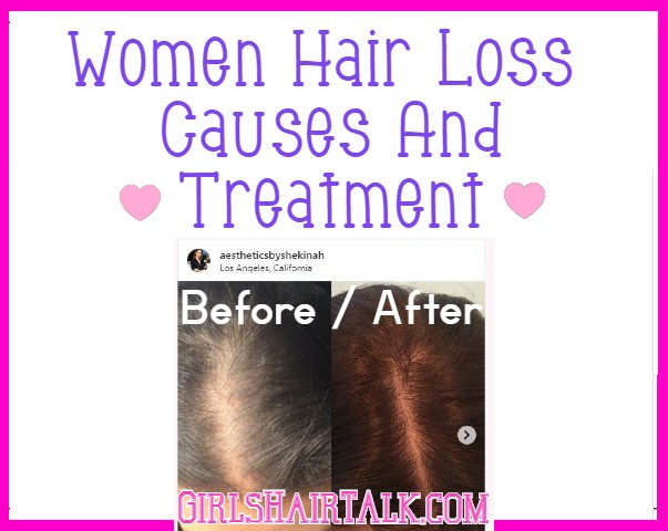 Women-Hair-Loss-Causes-And-Treatment.jpg