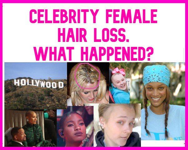 celebrity-female-hair-loss