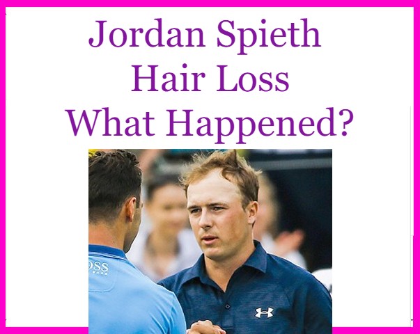 Jordan Spieth Hair loss blowing in the wind.