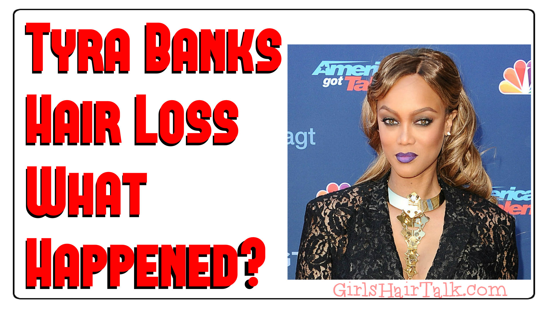 Tyra Banks Hair Loss: Celebrity Female Hair Loss